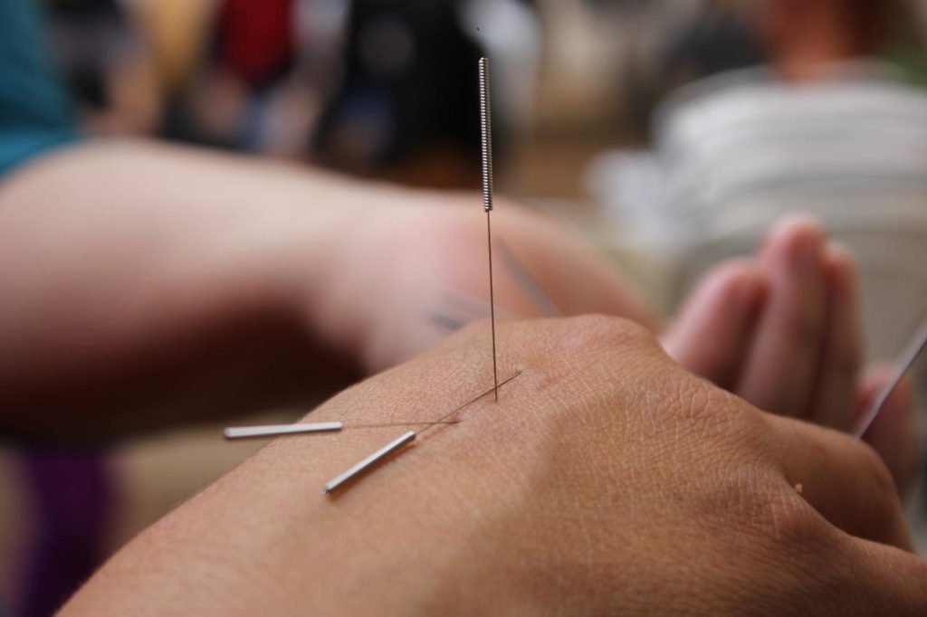 Acupuncturist in Purmerend voert professionele acupunctuurbehandeling uit voor pijnverlichting en welzijn
